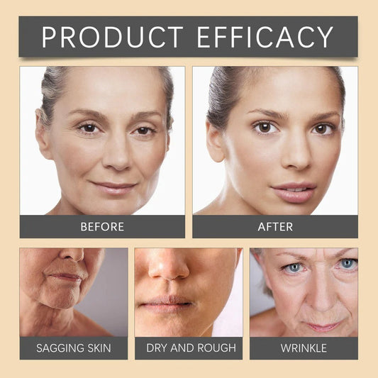 Bee Venom Botox Face Cream (100g) – Anti-Aging, Brightening & Firming