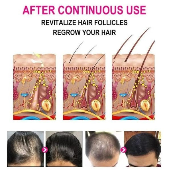 Anti-Grey Hair Serum (30ml) – Reverses Grey Hair, Restores Natural Color & Boosts Shine